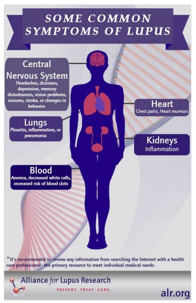 infographic of organs affected by lupus